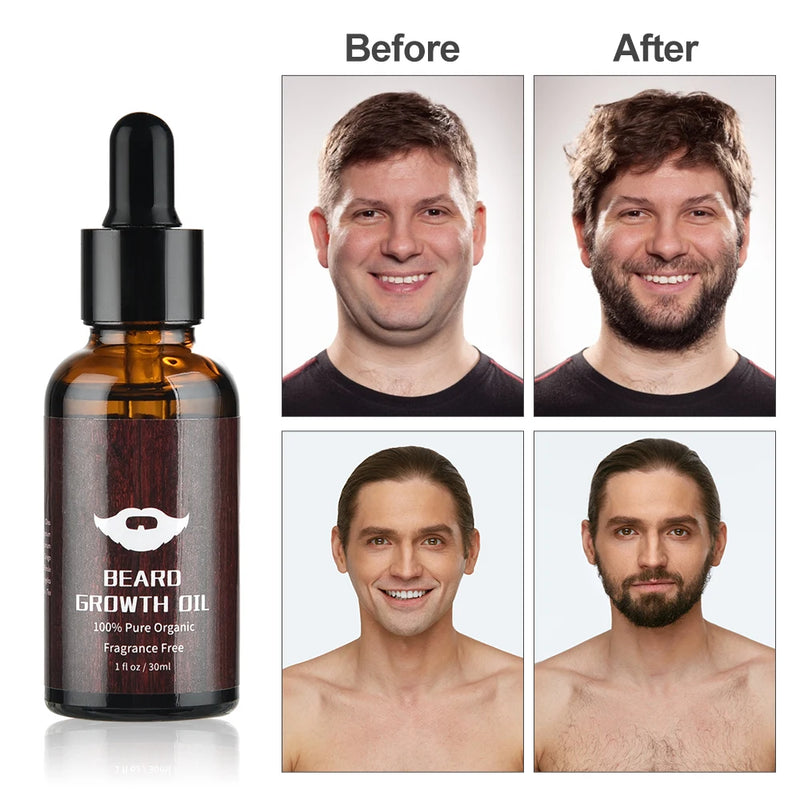 Kit Premium para Crescimento e Cuidado com a Barba – Ms.Dear (4 Peças)&nbsp;